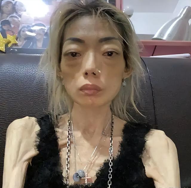 一代女神沦为豪门玩物？结婚8年牙齿全掉，器官切除，面似骷髅