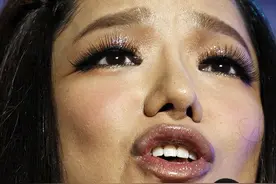 超女冠军江映蓉：整容失败弄得面目全非，被吐槽只剩眼珠是自己的图片