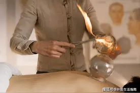 拔火罐时，后背吸出来的瘀血是毒素吗？医生告诉你大实话图片