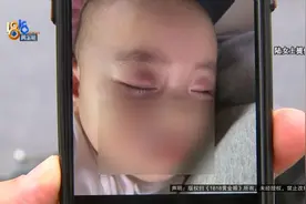 1岁宝宝眼皮红肿，一个月未消退，宝妈怀疑……图片