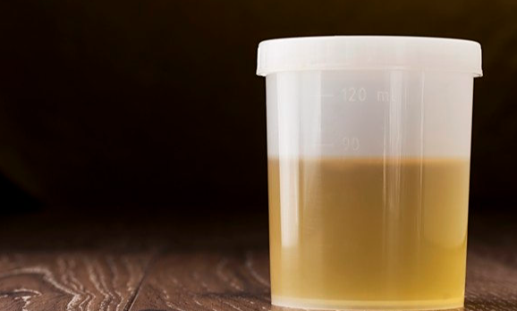 63岁女子皮肤瘙痒，以为是皮肤病	，体检后，医生叹：怎么不早来