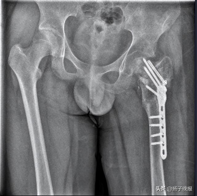 “跪举水盆、扇耳光、关小黑屋”，男孩被虐待28天致重伤二级，校长和3名教官被刑拘，4人涉嫌虐待罪被起诉