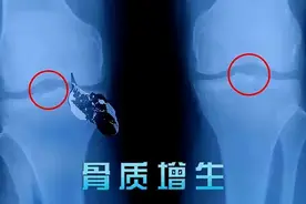 补肾强腰名方青蛾丸！4味药材，壮筋骨，治愈多年腰椎骨质增生图片