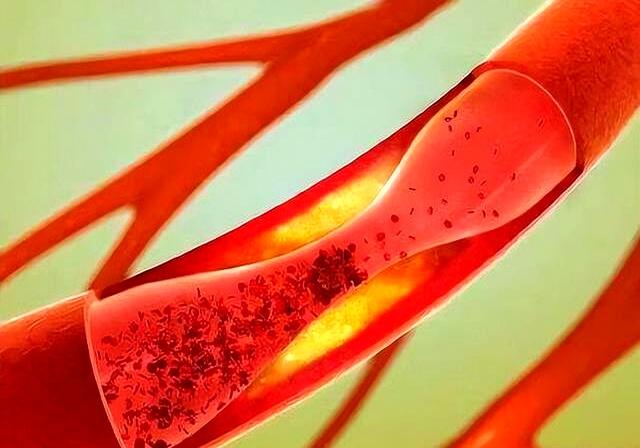 低温天气究竟如何科学健身钟南山提醒天冷运动需注意五点