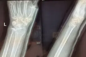 正骨学术思想与其特色正骨手法如何应用？图片