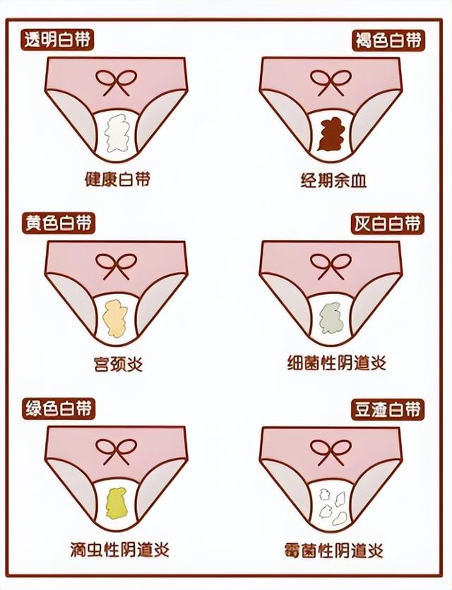 你的白带正常吗，中医一次给你讲透，必看！