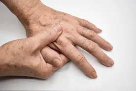 类风湿病人想要在冬天少发作，过冬要牢记这5点，或对身体有帮助图片