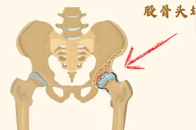 孙思邈千金方，专治股骨头坏死，补肝益肾、活血化瘀，除痹痛！图片