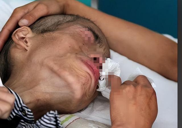离死亡最近的3个月，肿瘤患者会出现5个症状，希望你一定都没有！