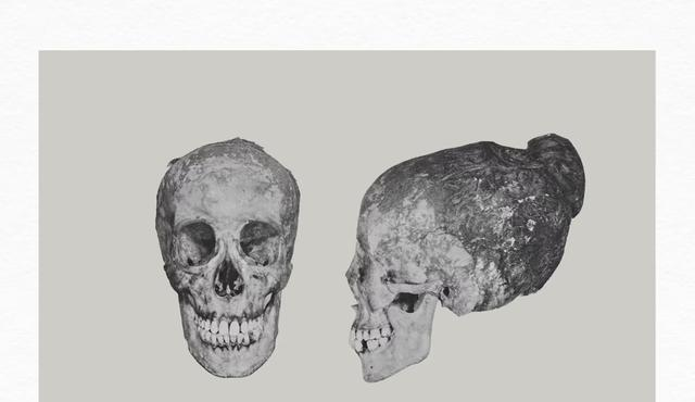 德川家定首任妻子兼皇室公主的天亲院遗骨发掘