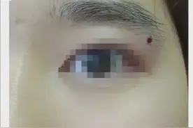 已有多人中招！充电时突遭“枪击”，缝了8针，“牙齿差点掉了”图片