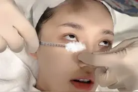 28岁星女郎林允再次公开医美，往脸上打针维持美貌，直喊真疼图片