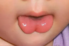 婴儿总是吐舌头，暗示着3大信号，早知道别耽误宝宝发育图片