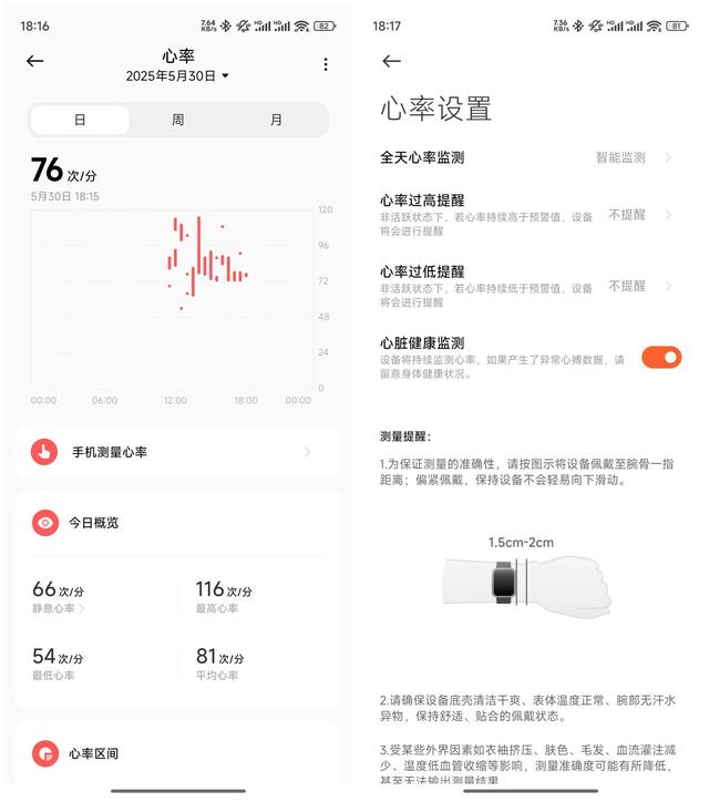评测｜REDMI Watch 5 eSIM 窄边框大屏，功能丰富