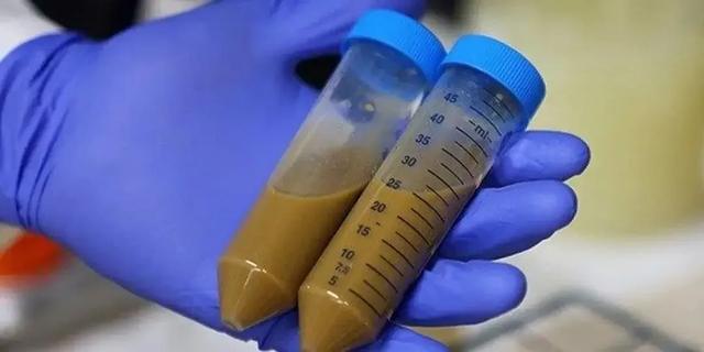 你能想象吗？大便经过加工，还能被我们吃掉