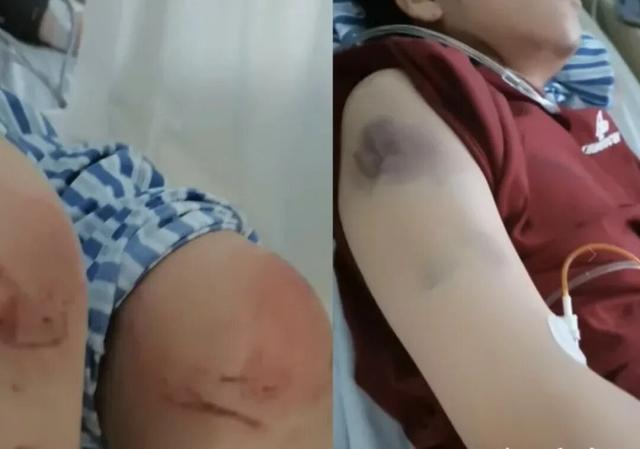 河北女子遭家暴驾车逃跑致丈夫死亡案开庭	，女子父亲谈案发细节：她被扒光衣服遭持刀威胁，逃命还能逃出罪来