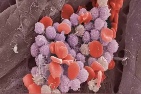 经常放屁，是癌症预警？医生提醒：放屁多，或与4种疾病有关图片