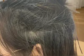 白头发越长越多 可能是缺这种营养 建议多吃3 种食物 头发乌黑还滑顺图片