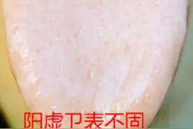 动不动出汗玉屏风散不是第一，这3个更全面，虚汗盗汗自汗都能用图片