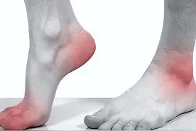 医生：确诊为痛风的人，一定要补充几种物质，也许能减少痛风发作图片