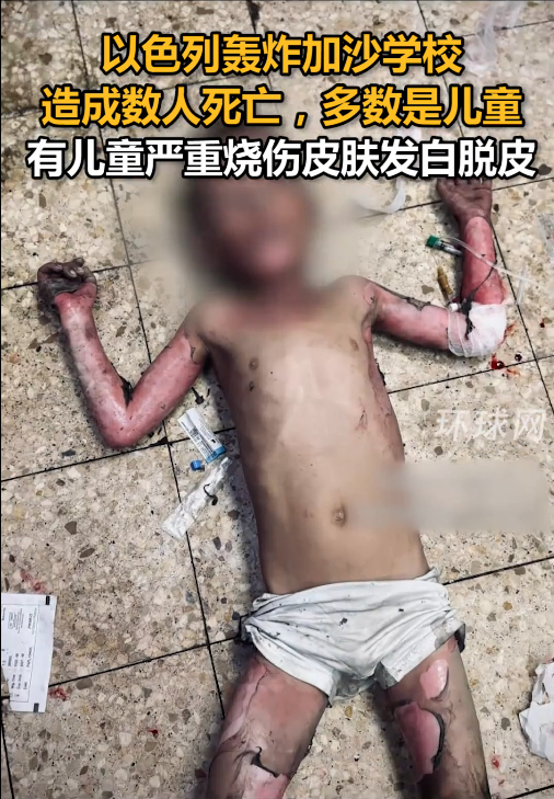 以军轰炸加沙学校造成数人死亡