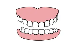 整口牙都掉光了，种牙好还是戴活动假牙好？图片