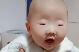 儿子出生“没眼睛”，爸妈吓得丢了魂，医生检查后笑出了声图片