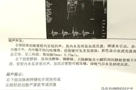 他得糖尿病30年，现在严重并发症，都不想活了，医生也没办法图片