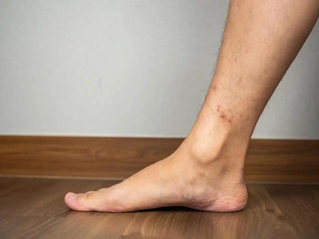 医生提醒：做过心脏支架手术，身体若出现这几种异常，要当心。