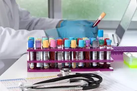 怀疑自己得了甲亢？别怕，这些检查来“救场”！图片