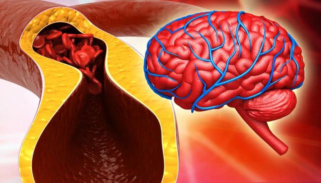 医生:高血脂患者几种食物要经常吃,能辅助控制血脂!来了解