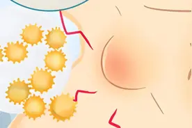淋巴结肿大别慌，教你看部位辨风险图片