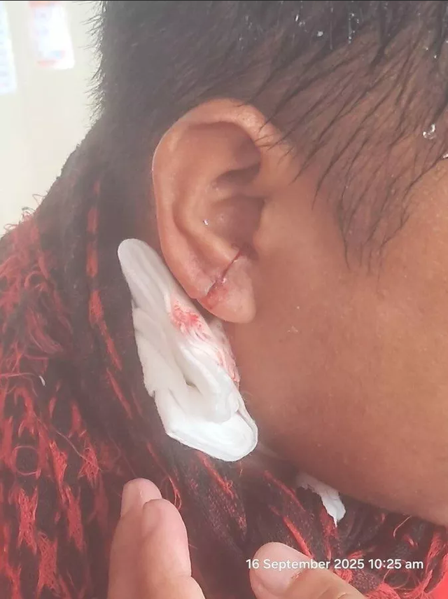 菲船故意撞击中国海警船，被水炮打碎窗户有人受伤，摇白旗投降