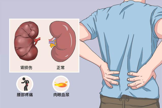 慢性肾衰竭的分期标准是什么？肌酐多少算肾衰竭？详细解析