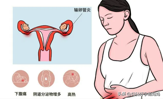 久备不孕，当心是输卵管“生锈了”！给你一张“孕通方”