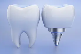 种植牙：我的亲身经历和深刻心得图片