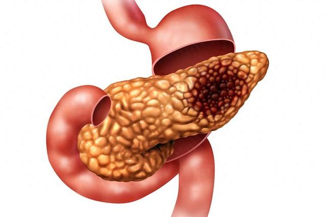 胰腺要保护好，医生劝老年人：别太节省，常吃这几样，健康美味