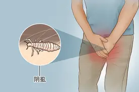 男子腹部痒，医生用镊子夹出12只阴虱！原来阴虱有这3个传播途径图片