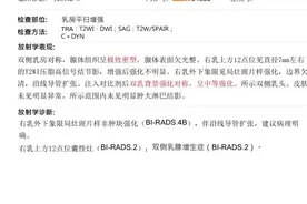 乳腺结节4B选手的化险为夷图片