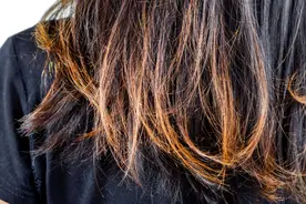 头发是精血的镜子，一个中成药肝肾同调精血同补，让头发乌黑浓密图片