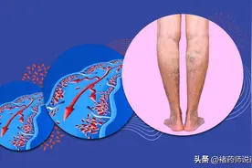 吃利伐沙班，饭前饭后有讲究图片