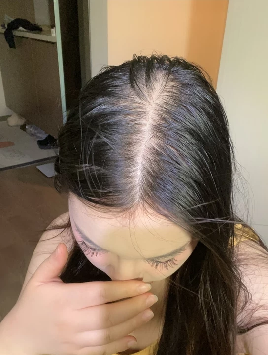 头皮细胞通讯网络优化仪：专利间隙连接技术如何增强组织协调