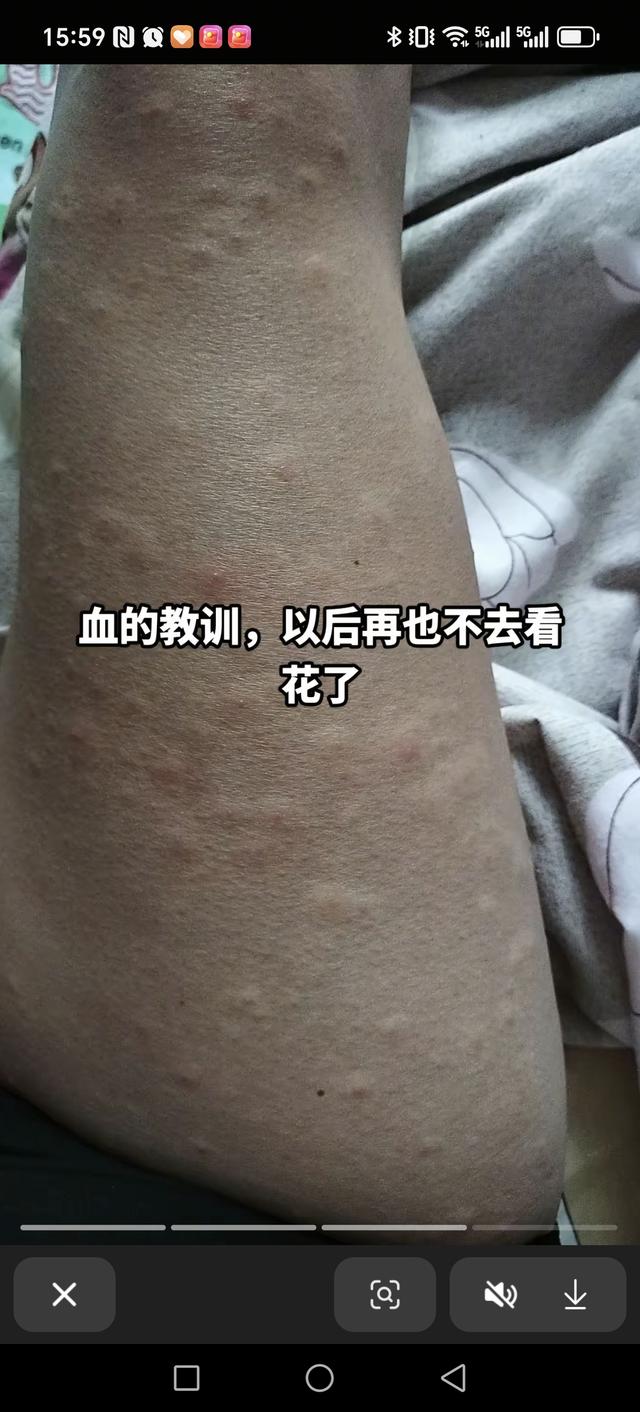 《花粉过敏者的"吃鸡"攻略：从青铜到王者的装备升级》