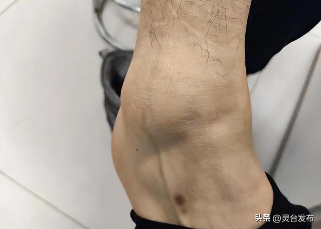 高血压与穿袜子有关？医生强调：穿袜子时，要多留意这3点！