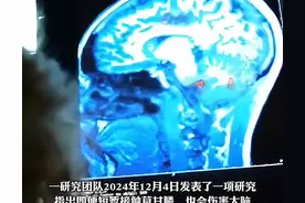 农民除草用的“草甘膦”会损伤小鼠的大脑，引发脑炎，且持续性久图片