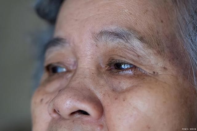 医生告诫：青光眼早期不是眼痛，而是身上4种异常，早察觉早治疗