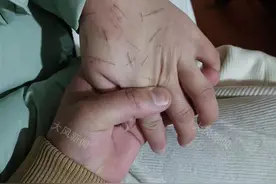 女孩在3家宾馆遭性侵，4涉案人分别获刑，法院判每家宾馆承担补充责任赔偿5000元图片