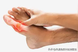痛风的四个阶段分别有何症状？了解清楚才能降低危害！图片