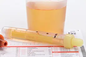 9岁的小女孩，尿液呈红色，里面还有血丝，孩子尿血是咋回事？图片