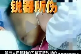 惊爆！广东六岁女童手指耳朵被剁掉，行凶之人你绝对想不到！图片